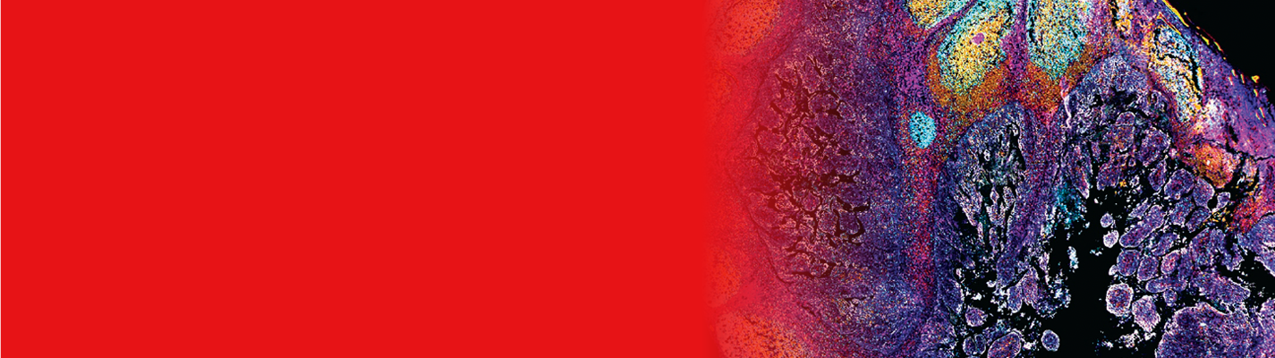 Thermofisher CMP Landing Page Banner - 21.08.25
